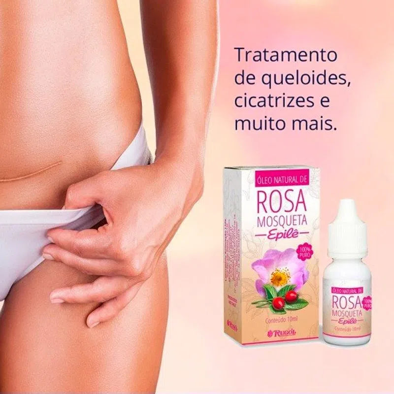 Óleo Epilê Rosa Mosqueta - 10ml