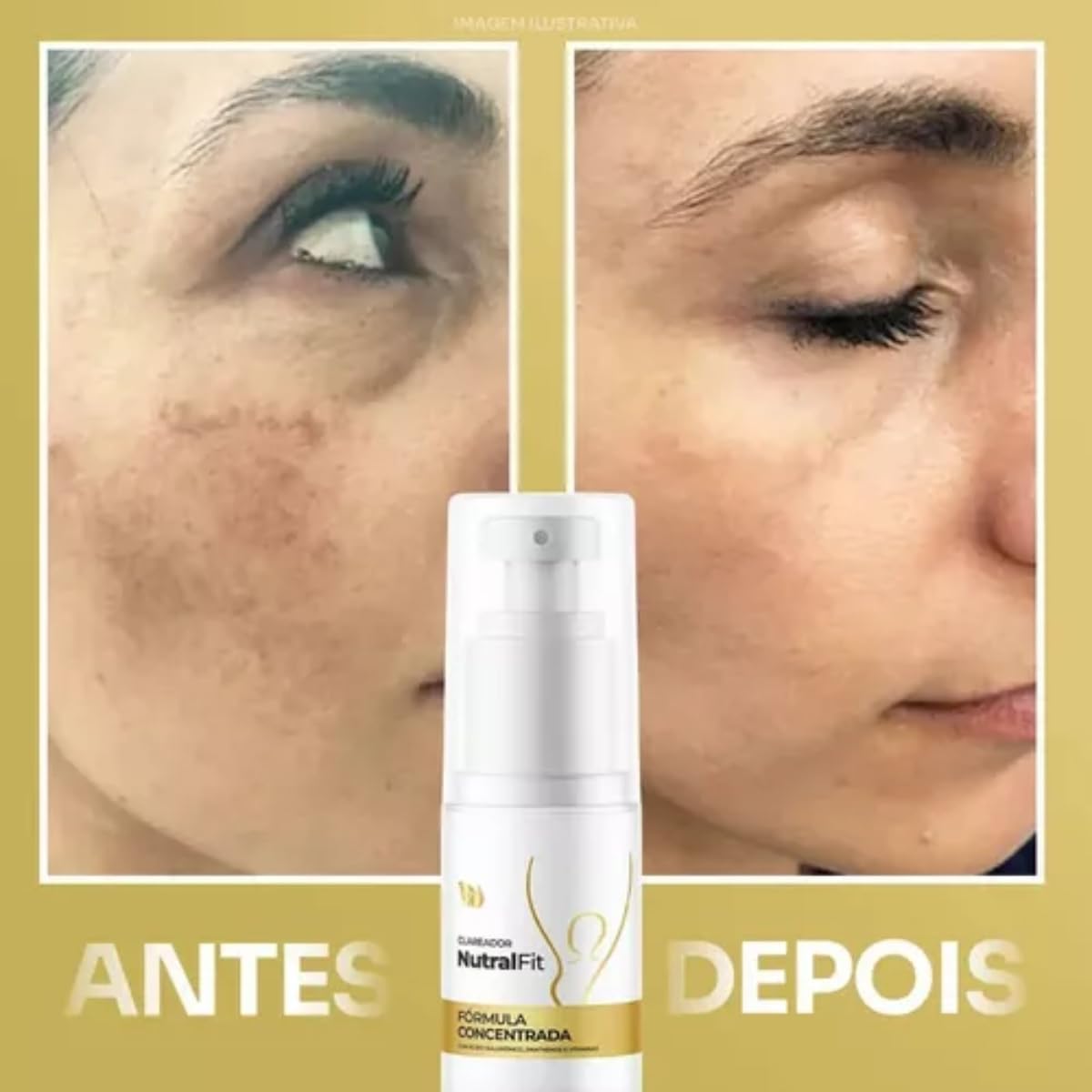 Clareador Nutralfit Manchas E Melasma Nutral Fit Corpo Rosto - 50ml