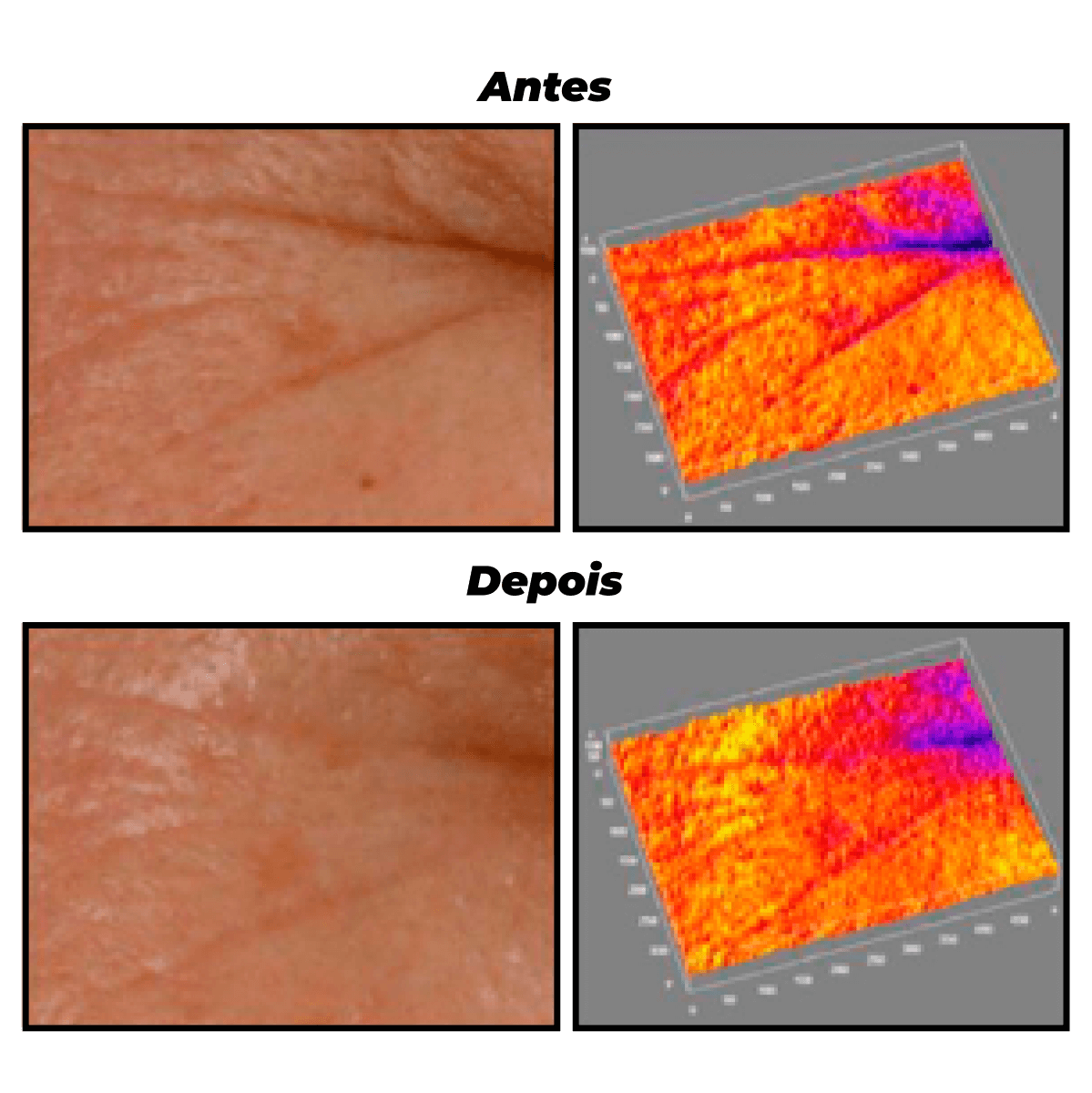 Creme de Tratamento Anti-Idade Intensivo Retinol 30g