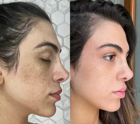 ESPUMA | CLEAN YOUR SKIN