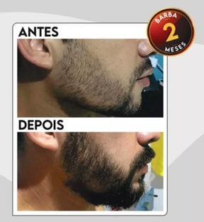 Tônico Capilar Minoxi 15 Barba E Cabelo - 120ml