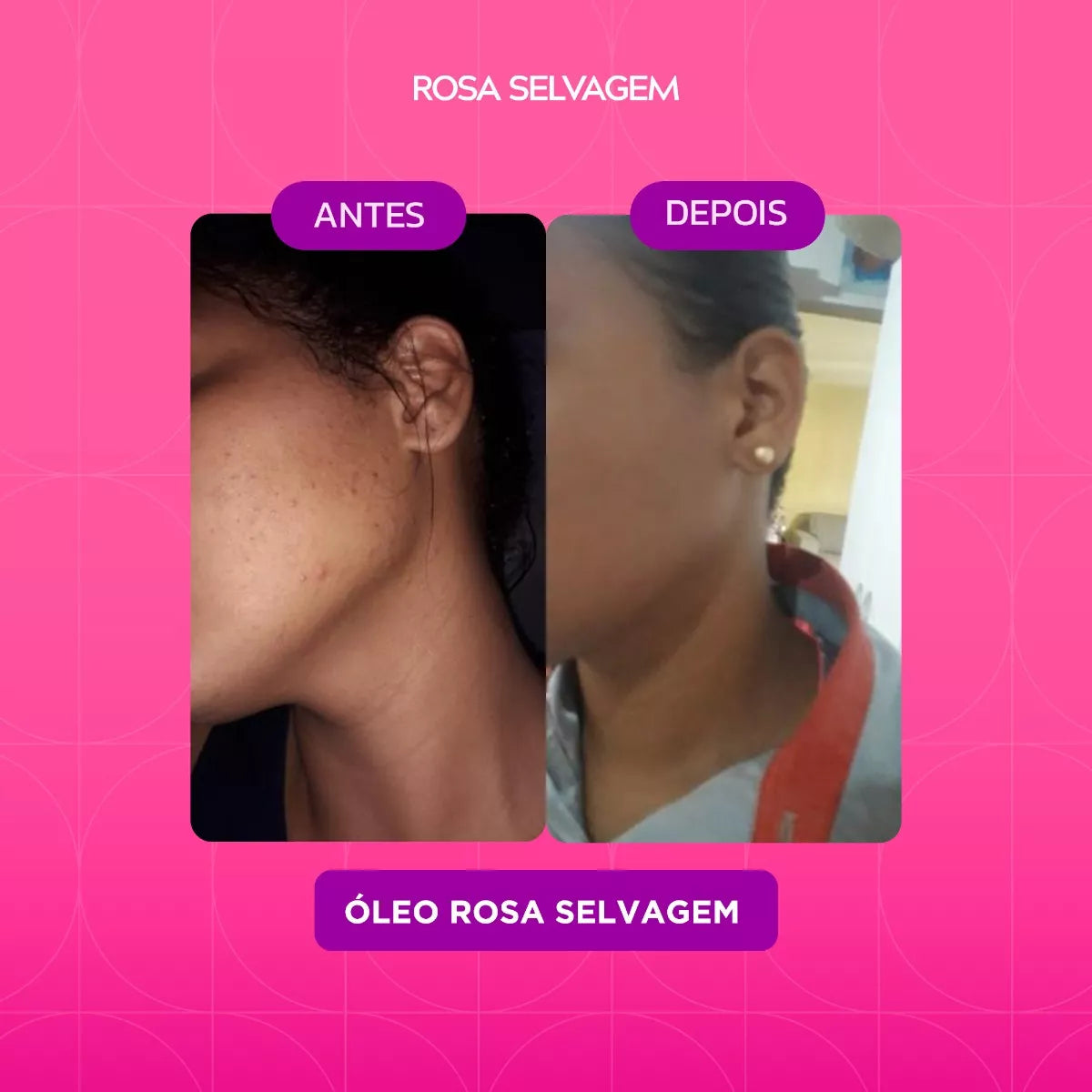 Rosa Selvagem Óleo Clareador Corporal - 100ml