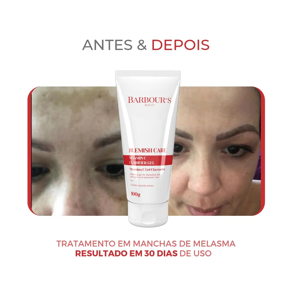 Blemish Care Whitening Gel with Vitamin C - 100g